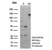 SDS-PAGE analysis of purified, BSA-free recombinant Desmocollin-2/3 antibody (clone DSC2/9165R) as confirmation of integrity and purity.