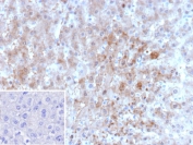 IHC staining of FFPE human liver tissue with ARK1C1 antibody (clone AKR1C1/9062). Inset: PBS used in place of primary Ab (secondary Ab negative control). HIER: boil tissue sections in pH 9 10mM Tris with 1mM EDTA for 20 min and allow to cool before testing.