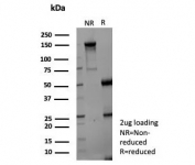 SDS-PAGE analysis of purified, BSA-free AKR1C1 antibody (clone AKR1C1/9070) as confirmation of integrity and purity.
