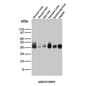 AKR1C1 Antibody Multi-Species Liver Panel WB. Western blot analysis of (1) human liver, (2) mouse liver, (3) rat liver, (4) hamster liver, (5) guinea pig liver, and (6) HepG2 cell lysates using AKR1C1 Antibody (clone AKR1C1/9070) detects a band at approximately 37 kDa, consistent with the predicted molecular weight of AKR1C1 / Aldo-keto reductase family 1 member C1. The conserved banding pattern across species and in HepG2 cells supports reliable detection of AKR1C1 in hepatic tissue, aligning with its role in steroid metabolism and detoxification pathways.