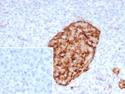 Immunohistochemistry of GAD2 Antibody Recombinant Mouse MAb rGAD2/9382 in human pancreas. Formalin-fixed, paraffin-embedded human pancreatic tissue demonstrates strong HRP-DAB brown cytoplasmic staining in islet cells, consistent with Glutamate decarboxylase 2 expression in pancreatic neuroendocrine cells. Surrounding exocrine acinar tissue shows minimal staining. The inset shows PBS used in place of the primary antibody as a negative control. Heat-induced epitope retrieval was performed by boiling tissue sections in pH 9 10mM Tris with 1mM EDTA for 20 min followed by cooling prior to antibody incubation.