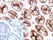 Immunohistochemistry of CDH17 antibody in human colon tissue. The recombinant mouse mAb clone rCDH17/9677 demonstrates strong membranous HRP-DAB brown staining along the lateral borders of colonic epithelial cells, consistent with Cadherin 17 localization in intestinal epithelium. Staining highlights well-formed glandular crypt structures with preserved apical-basal polarity, while surrounding stromal tissue shows minimal background signal. The negative control inset, using PBS in place of the primary antibody, shows no specific staining. Heat-induced epitope retrieval was performed by boiling tissue sections in pH 9 10mM Tris with 1mM EDTA for 20 minutes followed by cooling prior to incubation.