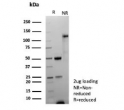 SDS-PAGE analysis of purified, BSA-free recombinant TDP43 antibody (clone TARDP/9299R) as confirmation of integrity and purity.