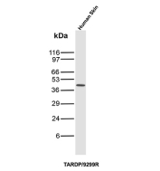 TDP43 Antibody Rabbit Monoclonal Human Skin WB. Western blot analysis of human skin tissue lysate using rabbit monoclonal TDP43 antibody clone TARDP/9299R. A distinct band is detected at approximately 43 kDa, consistent with the expected molecular weight of TAR DNA-binding protein 43 / TDP43, a nuclear RNA-binding protein involved in RNA processing, transcriptional regulation, and stress granule-associated signaling pathways.