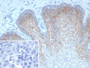TRIM29 Antibody Esophagus IHC. Immunohistochemistry staining of formalin-fixed, paraffin-embedded human esophagus tissue using recombinant rabbit monoclonal clone TRIM29/9256R demonstrates cytoplasmic and nuclear HRP-DAB brown staining within squamous epithelial cells, with strongest signal observed in basal and suprabasal epithelial layers. The staining pattern is consistent with expression of Tripartite motif-containing protein 29 / TRIM29 in stratified epithelial tissue and squamous differentiation-associated cellular populations. Inset: PBS was used in place of primary antibody as a negative control. Heat-induced epitope retrieval was performed by boiling tissue sections in pH 9 10mM Tris with 1mM EDTA for 20 min followed by cooling prior to antibody incubation.
