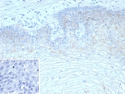 Immunohistochemistry of Tripartite motif-containing protein 29 antibody in human esophagus. Formalin-fixed, paraffin-embedded human esophageal tissue was stained using the recombinant rabbit monoclonal clone TRIM29/9257R. HRP-DAB brown chromogenic signal demonstrates cytoplasmic and nuclear staining in squamous epithelial cells, with strongest signal observed in the basal and suprabasal layers. The inset shows PBS used in place of primary antibody as a negative control, confirming staining specificity. Heat-induced epitope retrieval was performed by boiling tissue sections in pH 9 10mM Tris with 1mM EDTA for 20 min followed by cooling prior to antibody incubation.