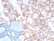 Immunohistochemistry analysis of TrkB / NTRK2 antibody (clone NTRK2/7929) in human thyroid tissue. FFPE human thyroid tissue shows membranous and cytoplasmic HRP-DAB brown staining in follicular epithelial cells, while surrounding stromal elements are largely negative. The inset shows the negative control with PBS used in place of the primary antibody, demonstrating absence of HRP-DAB brown signal. Heat-induced epitope retrieval was performed by boiling tissue sections in pH 9 10mM Tris with 1mM EDTA for 20 min followed by cooling prior to staining.