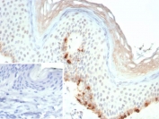 MLANA Antibody human skin IHC staining. Immunohistochemistry analysis of Melan A (MLANA) in FFPE human skin using MLANA Antibody / Melanocyte Lineage Marker Antibody clone rMLANA/9404 demonstrates cytoplasmic HRP-DAB brown staining in melanocytes localized along the basal layer of the epidermis, consistent with melanocyte lineage distribution, while surrounding keratinocytes and dermal cells remain largely negative. The staining pattern highlights discrete melanocyte populations with clear localization and minimal background signal. The inset shows a negative control with PBS in place of the primary antibody, confirming staining specificity. Heat-induced epitope retrieval was performed using pH 9 Tris-EDTA buffer for 20 min prior to staining.