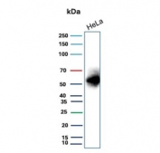 Western blot testing of human HeLa cell lysate with recombinant Carbonic Anhydrase IX antibody. Predicted molecular weight: 50-55 kDa but may be observed at higher molecular weights due to glycosylation.