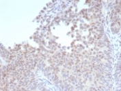 Estrogen Receptor beta 1 Antibody Bladder IHC. Immunohistochemistry staining of FFPE human bladder tissue with recombinant Estrogen Receptor beta 1 antibody (clone ESR2/9251R). HIER: boil tissue sections in pH 9 10mM Tris with 1mM EDTA for 20 min and allow to cool before testing.
