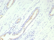 SLC45A3 Antibody for IHC. Immunohistochemistry analysis of Prostein / SLC45A3 antibody staining in FFPE human prostate tissue using clone SLC45A3/9216R. Strong cytoplasmic and perinuclear staining is observed in prostate glandular epithelial cells lining the luminal structures, consistent with Golgi-associated localization of Prostein, while surrounding stromal cells remain negative. The staining pattern highlights epithelial cell morphology and glandular architecture, supporting the role of SLC45A3 as a prostate-restricted marker in immunohistochemistry. Heat-induced epitope retrieval was performed in pH 9 Tris-EDTA buffer for 20 minutes followed by cooling prior to antibody incubation.