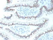 IHC staining of FFPE human colon tissue with recombinant CDX2 antibody (clone CDX2/9298R). HIER: boil tissue sections in pH 9 10mM Tris with 1mM EDTA for 20 min and allow to cool before testing.
