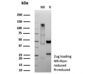 SDS-PAGE analysis of purified, BSA-free recombinant CDX2 antibody (clone CDX2/9298R) as confirmation of integrity and purity.