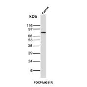 FOXP1 Antibody Ramos WB. Western blot analysis of Ramos cell lysate using FOXP1 Antibody clone FOXP1/9381R. A distinct band is detected at approximately 75-80 kDa, consistent with the expected molecular weight of Forkhead box protein P1 / FOXP1, a transcription factor involved in B-cell differentiation, lymphoid development, and transcriptional regulation. The observed signal is consistent with the established expression of FOXP1 in B-cell lineage-derived Ramos cells.