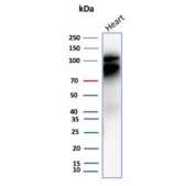 Western blot testing of human heart tissue lysate with Cadherin 2 antibody (clone CDH2/9488). Predicted molecular weight ~100 kDa (unmodified), 125-140 kDa (modified).