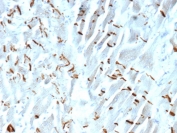 Cadherin 2 Antibody Human Heart IHC. Immunohistochemistry staining of FFPE human heart tissue with Cadherin 2 antibody (clone CDH2/9490). HIER: boil tissue sections in pH 9 10mM Tris with 1mM EDTA for 20 min and allow to cool before testing.
