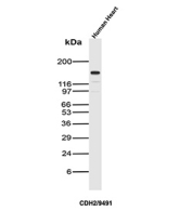 Cadherin 2 Antibody Heart Tissue WB. Western blot analysis of N-Cadherin / CDH2 expression in human heart tissue lysate using Cadherin 2 antibody clone CDH2/9491. Lane 1: human heart lysate. A strong band is detected at approximately 120-135 kDa, consistent with the predicted molecular weight of N-Cadherin (CDH2), with the higher apparent migration reflecting known glycosylation of this adhesion protein. A faint lower band is also observed, which may represent partial proteolytic processing or degradation. The robust signal in cardiac tissue is consistent with the established role of N-Cadherin in cardiomyocyte adhesion and intercalated disc formation.