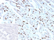 Cadherin 2 Antibody IHC. Immunohistochemistry staining of FFPE human heart tissue with Cadherin 2 antibody (clone CDH2/9493). Inset: PBS used in place of primary Ab (secondary Ab negative control). HIER: boil tissue sections in pH 9 10mM Tris with 1mM EDTA for 20 min and allow to cool before testing.