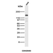 Cadherin 2 Antibody WB. Western blot analysis of N-Cadherin / CDH2 expression in A549 cell lysate using Cadherin 2 antibody clone CDH2/9493. Lane 1: A549 cell lysate. A distinct band is detected at approximately 120-135 kDa, consistent with the predicted molecular weight of N-Cadherin (CDH2), with the slightly higher apparent migration reflecting known glycosylation of this transmembrane adhesion protein. Additional faint lower bands may represent proteolytic processing or degradation products. The observed expression in A549 cells is consistent with N-Cadherin involvement in epithelial-to-mesenchymal transition and tumor-associated cellular remodeling.