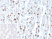 Cadherin 2 Antibody Human Heart Tissue IHC. Immunohistochemistry staining of FFPE human heart tissue with Cadherin 2 antibody (clone CDH2/9494). Inset: PBS used in place of primary Ab (secondary Ab negative control). HIER: boil tissue sections in pH 9 10mM Tris with 1mM EDTA for 20 min and allow to cool before testing.