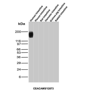 CEA Antibody Cross-Species Intestine WB. Western blot analysis of CEA / CEACAM5 expression using CEA antibody, clone CEACAM5/12673. Lane 1: human intestine lysate, Lane 2: mouse intestine lysate, Lane 3: rat intestine lysate, Lane 4: hamster intestine lysate, Lane 5: guinea pig intestine lysate, Lane 6: rabbit intestine lysate. A strong band is detected at approximately 180-200 kDa in human intestine, consistent with the predicted molecular weight of heavily glycosylated CEACAM5, while no comparable band is observed in the tested non-human intestine samples, supporting selective recognition of human CEA under these western blot conditions.