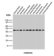 Western blot analysis of Human Brain, Mouse Brain, Rat Brain, Hamster Brain, Guinea pig Brain, Human Stomach, Mouse Stomach, Rat Stomach, Hamster Stomach and Guinea pig Stomach tissue lysates using Creatine kinase B-type antibody (clone CKBB/6636). Predicted molecular weight ~43 kDa.