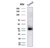 Clusterin Antibody Tonsil Tissue WB. Western blot analysis of human tonsil tissue lysate using Clusterin antibody for IHC. The mouse monoclonal antibody clone CLU/4740 detects bands at approximately 75-80 kDa and lower molecular weight bands around 34-39 kDa, consistent with the predicted molecular weight of full-length Clusterin / CLU and its processed alpha and beta subunits. This banding pattern reflects proteolytic cleavage and glycosylation of this secreted chaperone protein, aligning with its synthesis and extracellular accumulation observed in tissue staining.