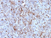 IHC staining of FFPE human adrenal gland tissue with Clusterin antibody (clone CLU/12058). HIER: boil tissue sections in pH 9 10mM Tris with 1mM EDTA for 20 min and allow to cool before testing.