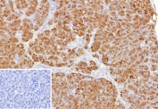 IHC staining of FFPE human pancreas tissue with Colipase antibody (clone CLPS/9901). Inset: PBS used in place of primary Ab (secondary Ab negative control). HIER: boil tissue sections in pH 9 10mM Tris with 1mM EDTA for 20 min and allow to cool before testing.