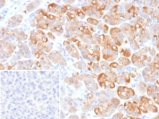 IHC staining of FFPE human pancreas tissue with CLPS antibody (clone CLPS/9902). Inset: PBS used in place of primary Ab (secondary Ab negative control). HIER: boil tissue sections in pH 9 10mM Tris with 1mM EDTA for 20 min and allow to cool before testing.