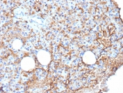 IHC staining of FFPE human parathyroid tissue with CD109 antibody (clone CD109/9949). HIER: boil tissue sections in pH 9 10mM Tris with 1mM EDTA for 20 min and allow to cool before testing.