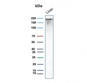 CPS1 Antibody Liver WB. Western blot analysis of Carbamoyl Phosphate Synthetase 1 / CPS1 in human liver tissue lysate using mouse monoclonal CPS1 antibody, clone CPS1/9859. A band is detected at approximately 165 kDa, consistent with the predicted molecular weight of CPS1, with signal occasionally observed at higher apparent molecular weights reflecting post-translational modification or protein complex association of this mitochondrial urea cycle enzyme.