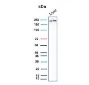 CPSase I Antibody Liver WB. Western blot analysis of Carbamoyl Phosphate Synthetase 1 / CPS1 in human liver tissue lysate using mouse monoclonal CPSase I antibody, clone CPS1/9869. A band is detected at approximately 165 kDa, consistent with the predicted molecular weight of CPS1, with additional signal observed at higher apparent molecular weights that may reflect post-translational modification or protein complex formation of this mitochondrial urea cycle enzyme.