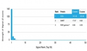 Decorin Antibody Microarray Validation. Analysis of HuProt(TM) microarray containing more than 19,000 full-length human proteins using Decorin antibody (clone DCN/3521). These results demonstrate the foremost specificity of the microarray validated DCN/3521 mAb. Z- and S- score: The Z-score represents the strength of a signal that an antibody (in combination with a fluorescently-tagged anti-IgG secondary Ab) produces when binding to a particular protein on the HuProt(TM) array. Z-scores are described in units of standard deviations (SD's) above the mean value of all signals generated on that array. If the targets on the HuProt(TM) are arranged in descending order of the Z-score, the S-score is the difference (also in units of SD's) between the Z-scores. The S-score therefore represents the relative target specificity of an Ab to its intended target.