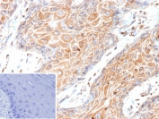 HBEGF Antibody Skin IHC. Immunohistochemistry analysis of FFPE human skin tissue stained with HBEGF antibody detecting Heparin-binding EGF-like growth factor (HB-EGF), clone HBEGF/9503. Epidermal keratinocytes show membranous and cytoplasmic staining, consistent with expression of proHB-EGF at the cell surface and its role as a heparin-binding EGFR ligand involved in epithelial signaling and tissue repair. The staining pattern highlights epithelial cell layers, while underlying dermal components show comparatively lower signal. The inset shows a PBS-only negative control processed without primary antibody, confirming minimal non-specific background staining. Hematoxylin counterstain highlights nuclei in blue. HIER: boil tissue sections in pH 9 10 mM Tris with 1 mM EDTA for 20 min and allow to cool before testing.