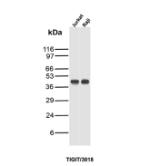 TIGIT Antibody Jurkat Raji WB. Western blot analysis of Jurkat and Raji cell lysates using TIGIT Antibody (clone TIGIT/3018) detects a band at the predicted molecular weight of approximately 26-30 kDa, consistent with TIGIT expression in lymphoid cell lines, with slightly higher apparent molecular weight likely reflecting glycosylated forms of this immune checkpoint receptor.