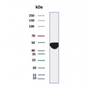 Tissue Factor Antibody WB. Western blot testing of human A431 cell lysate with Tissue Factor antibody (clone CD142/9195). Expected molecular weight: 33-50 kDa depending on glycosylation level.