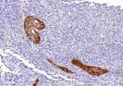 CD142 Antibody Human Lung Tissue IHC. Immunohistochemistry analysis of FFPE human lung tissue using CD142 antibody clone CD142/9196. Bronchial and vascular-associated epithelial structures demonstrate strong membranous and cytoplasmic HRP-DAB brown staining consistent with the surface-associated localization of CD142 / Tissue Factor in coagulation pathway activation, inflammatory signaling, and vascular injury-response pathways within pulmonary tissue. Surrounding stromal and lymphoid regions show comparatively lower staining intensity. Nuclei are counterstained blue. Heat-induced epitope retrieval was performed by boiling tissue sections in pH9 10 mM Tris with 1 mM EDTA for 20 minutes followed by cooling prior to staining.