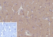 CD135 Antibody Brain Immunohistochemistry. IHC staining of FFPE human brain tissue with CD135 antibody (clone FLT3/9888). Inset: PBS used in place of primary Ab (secondary Ab negative control). HIER: boil tissue sections in pH 9 10mM Tris with 1mM EDTA for 20 min and allow to cool before testing.