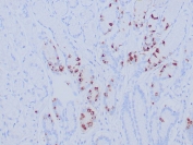 Recombinant Gastrin Antibody Gastric Antrum IHC. Immunohistochemistry staining of FFPE human gastric antrum tissue with recombinant Gastrin antibody (clone GAST/8646R). Inset: PBS used in place of primary Ab (secondary Ab negative control). HIER: boil tissue sections in pH 9 10mM Tris with 1mM EDTA for 20 min and allow to cool before testing.