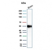 Western blot testing of human brain tissue with GFAP antibody (clone GFAP/9422). Predicted molecular weight ~50 kDa.