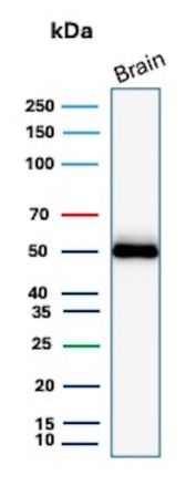 Western blot testing of human brain tissue with GFAP antibody (clone GFAP/9423). Predicted molecular weight ~50 kDa.
