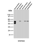 GFAP Antibody Brain Tissue WB. Western blot analysis of human brain, mouse brain, rat brain, hamster brain, guinea pig brain, and rabbit brain tissue lysates using GFAP Antibody clone GFAP/9423. Multiple closely migrating bands are detected between approximately 40-50 kDa in human brain lysate, with additional bands of similar molecular weight observed in rat, guinea pig, and rabbit brain samples, consistent with Glial fibrillary acidic protein / GFAP, a major astrocytic intermediate filament protein involved in maintenance of neural cytoskeletal organization and central nervous system architecture. The stacked banding pattern in the human brain sample likely reflects a combination of GFAP isoforms and partial proteolytic processing products commonly observed in neural tissue extracts.