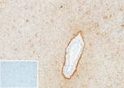 IHC staining of FFPE human brain tissue with GFAP antibody (clone GFAP/9424). Inset: PBS used in place of primary Ab (secondary Ab negative control). HIER: boil tissue sections in pH 9 10mM Tris with 1mM EDTA for 20 min and allow to cool before testing.