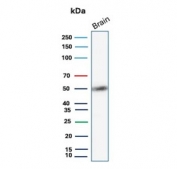 Western blot testing of human brain tissue with GFAP antibody (clone GFAP/9424). Predicted molecular weight ~50 kDa.