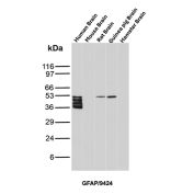 GFAP Antibody Brain Tissue WB. Western blot analysis of human brain, mouse brain, rat brain, guinea pig brain, and hamster brain tissue lysates using GFAP Mouse Monoclonal Antibody clone GFAP/9424. Multiple closely migrating bands are detected between approximately 40-50 kDa in human brain lysate, with additional bands of similar molecular weight observed in rat and guinea pig brain samples, consistent with Glial fibrillary acidic protein / GFAP, a major astrocytic intermediate filament protein involved in maintenance of neural cytoskeletal organization. The stacked banding pattern in the human brain sample likely reflects a combination of GFAP isoforms and partial proteolytic processing products commonly encountered in brain tissue extracts.
