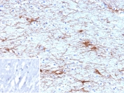 IHC staining of FFPE human brain tissue with Glial fibrillary acidic protein antibody (clone GFAP/9425). Inset: PBS used in place of primary Ab (secondary Ab negative control). HIER: boil tissue sections in pH 9 10mM Tris with 1mM EDTA for 20 min and allow to cool before testing.