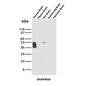GFAP Antibody Brain Tissue WB. Western blot analysis of human brain, mouse brain, rat brain, guinea pig brain, and hamster brain tissue lysates using Glial fibrillary acidic protein Antibody clone GFAP/9425. Multiple closely migrating bands are detected between approximately 40-50 kDa in human brain lysate, with an additional band of similar molecular weight observed in rat brain tissue, consistent with Glial fibrillary acidic protein / GFAP, a major astrocytic intermediate filament protein involved in maintenance of neural cytoskeletal architecture. The stacked banding pattern in the human brain sample likely reflects a combination of GFAP isoforms and partial proteolytic processing products commonly observed in brain tissue extracts.