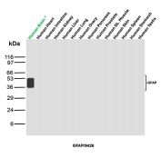 GFAP Antibody Multi-Tissue WB. Western blot analysis of human brain, heart, intestine, kidney, liver, lung, ovary, pancreas, prostate, skeletal muscle, skin, spleen, stomach, and testis tissue lysates using Glial fibrillary acidic protein Antibody clone GFAP/9426. A distinct band is detected at approximately 50 kDa selectively in human brain lysate, consistent with the predicted molecular weight of GFAP, an astrocyte-associated intermediate filament protein enriched within central nervous system tissue. Faint lower molecular weight signal broadening beneath the primary band likely reflects GFAP isoforms and/or partial proteolytic processing products commonly observed in neural tissue extracts.