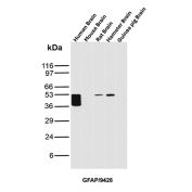 GFAP Antibody Brain Tissue WB. Western blot analysis of human brain, mouse brain, rat brain, hamster brain, and guinea pig brain tissue lysates using Glial fibrillary acidic protein Antibody clone GFAP/9426. Multiple closely migrating bands are detected between approximately 40-50 kDa in human brain lysate, with additional bands of similar molecular weight observed in rat and hamster brain samples, consistent with GFAP, a major astrocytic intermediate filament protein involved in maintenance of neural cytoskeletal organization and central nervous system integrity. The stacked banding pattern in the human brain sample likely reflects a combination of GFAP isoforms and partial proteolytic processing products commonly observed in neural tissue extracts.